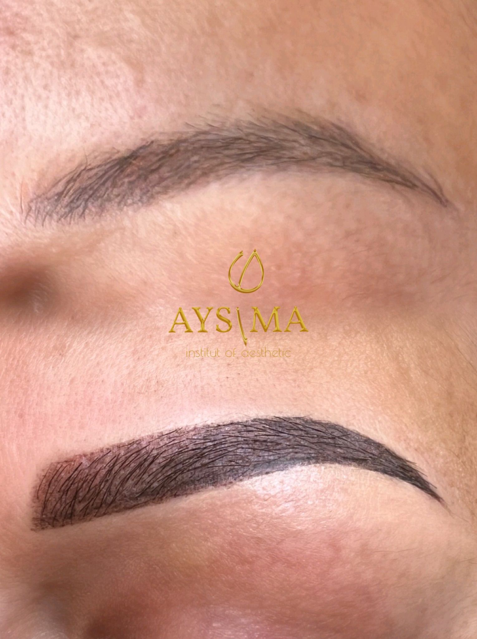 Aysima Institut – Peeling-Behandlung im Kosmetikstudio